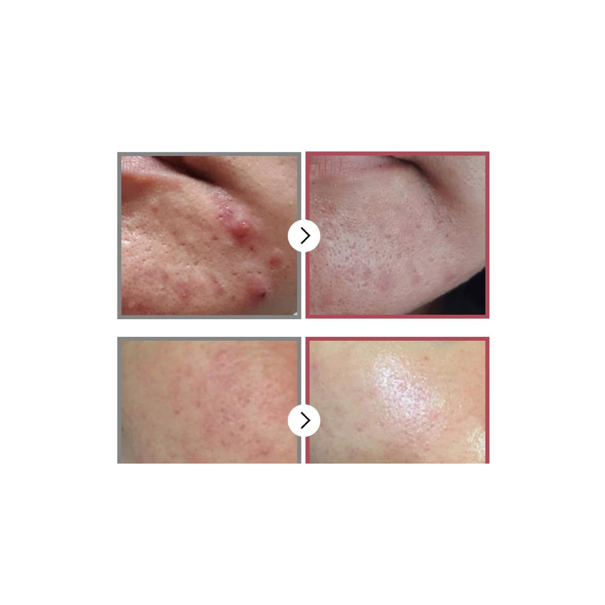 Numbuzin No.3 sérum lissant aux ferments et niacinamide, 50 ml