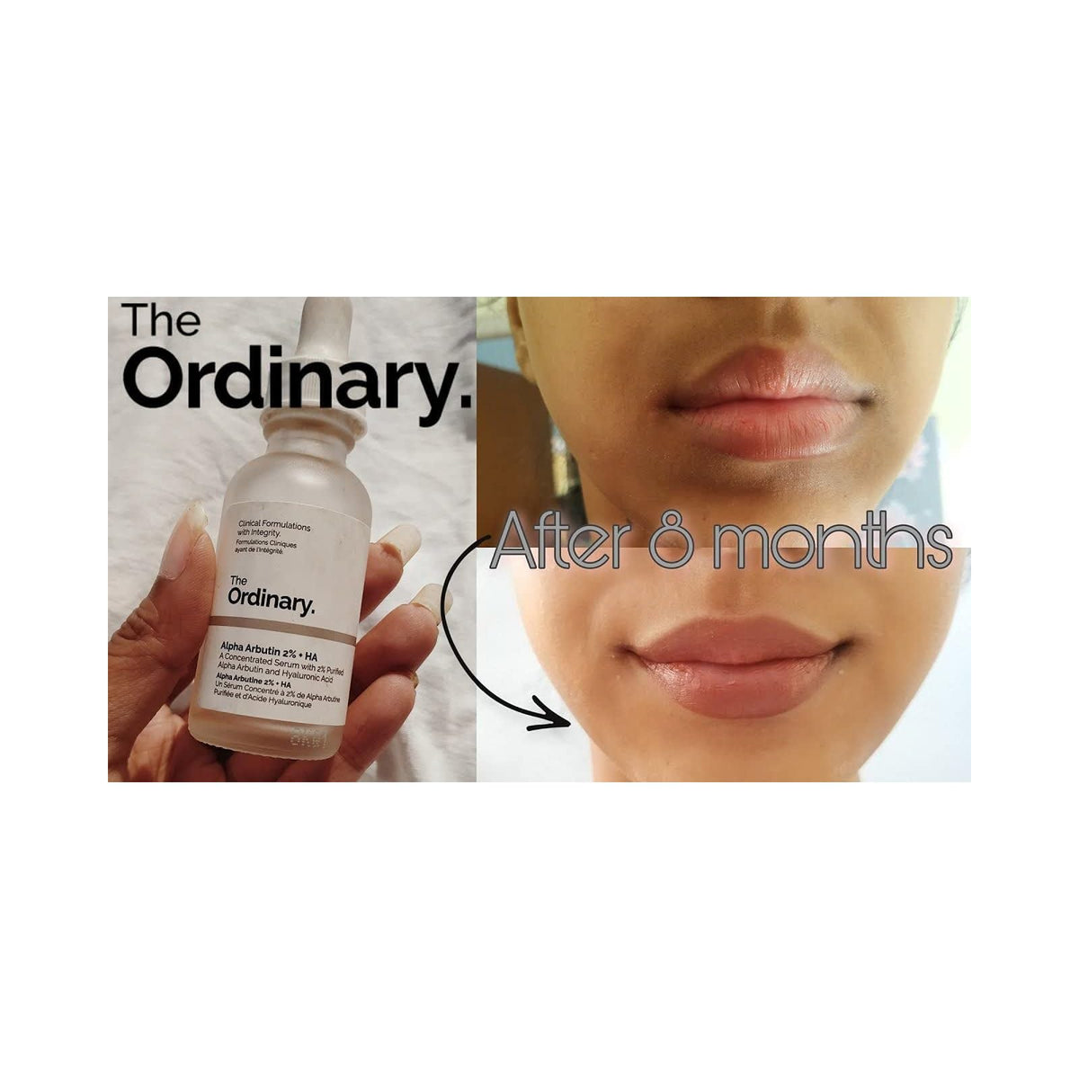 The Ordinary Alpha Arbutin 2 % + HA sérum anti-taches 30 ml