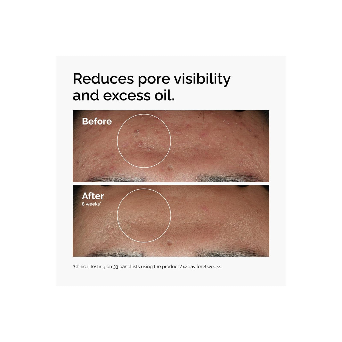 The Ordinary Niacinamide 10 % + Zinc 1 % sérum 30 ml