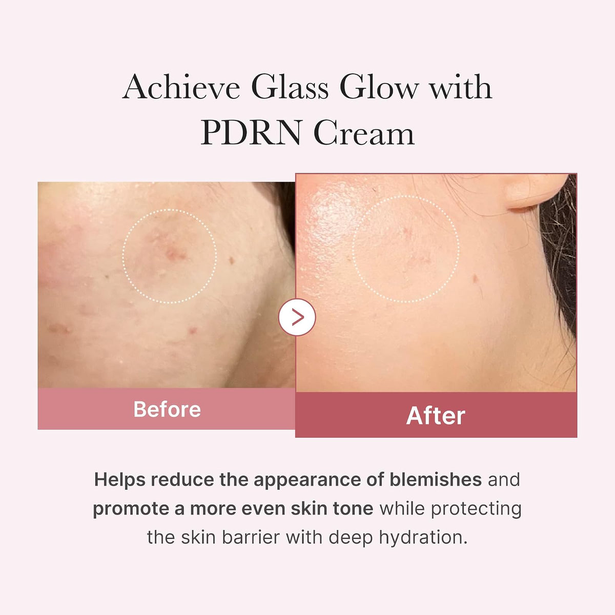 Medicube PDRN Pink Hyaluronic crème hydratante, 50 ml