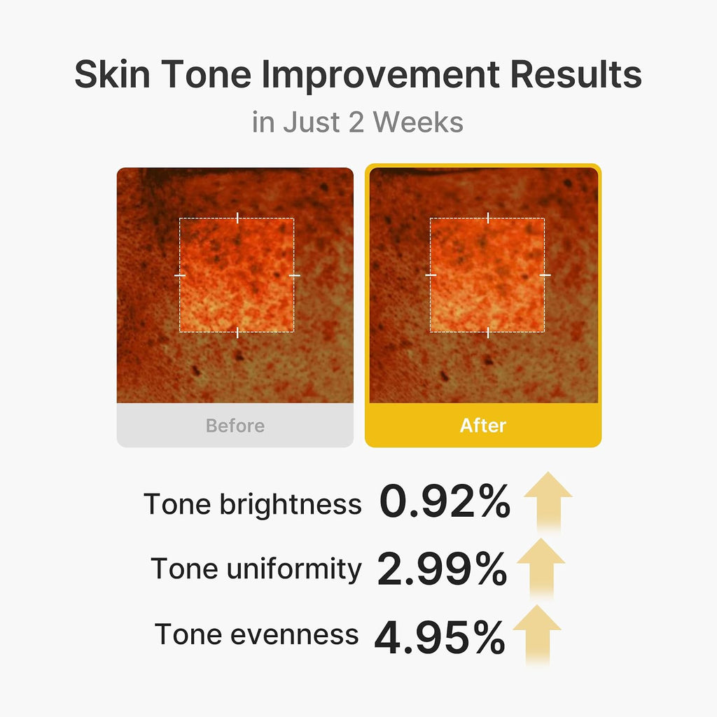 Medicube Kojic Acid Turmeric Vita crème à capsules, 55 g