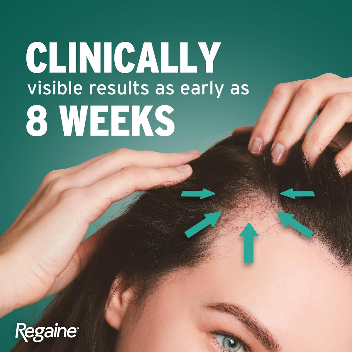 Regaine minoxidil 2 % solution pour femme 60 ml
